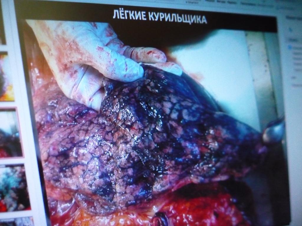 Нет курению 